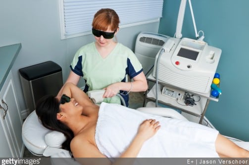 epilation-laser